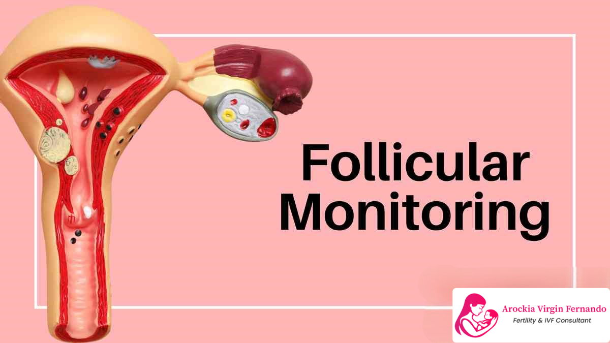 Follicle Growth Monitoring